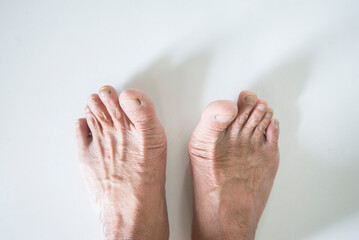 feet of a old man