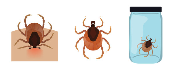 Mite biting skin, isolated and in jar for analysis