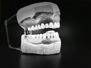 Wax prostheses in articulator on black background. Space for text.
