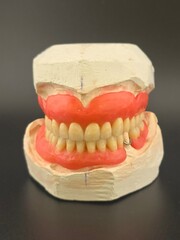 Wax prostheses in articulator on black background. 
