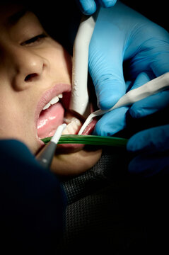 Close-up of young child having his teeth examined