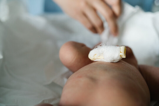 Doctor placing umbilical cord clamp on newborn baby after