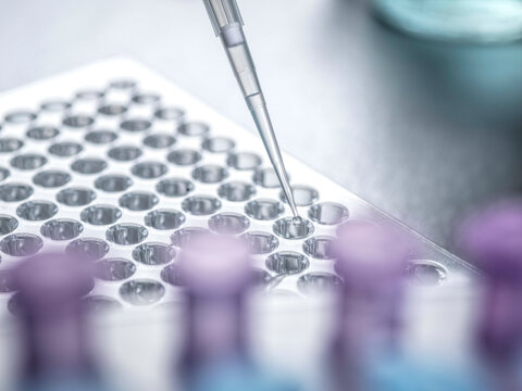 Close-up of pipette placing liquid into clear multi-well plate for laboratory testing.