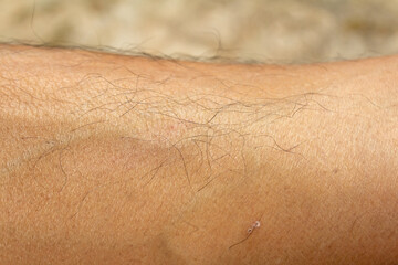 Close-Up of Human Skin with Fine Hair and Detailed Pores Texture – Realistic Dermatology...