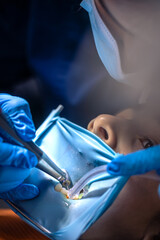 The dentist treats the child's tooth using a rubber dam. Close-up of tooth treatment.