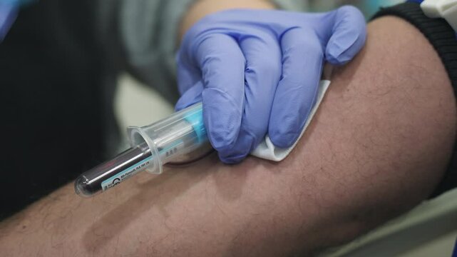 Nurse taking blood for test. Blood filling the tube test.