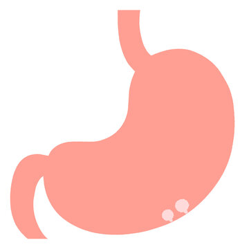 自覚症状のない良性のポリープがある胃のイラスト