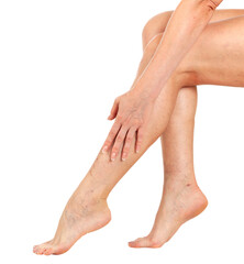 Female legs with vascular stars on the skin, isolated. Woman touches her shin with her hand