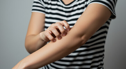 Itchy Skin Relief: Woman Scratching Arm, Eczema, Allergy, Rash Treatment & Care Tips for Healthy Skin, Dermatitis, Psoriasis, Pruritus