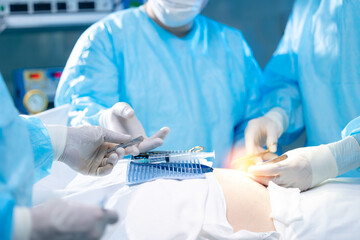 Surgical Team Performing an Operation in Sterile Hospital Environment