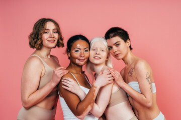 Group of multiethnic women with different kind of skin posing together in studio. Concept about...