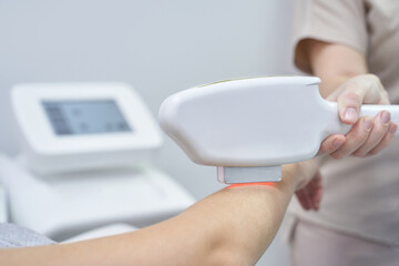 Close up of laser hair removal procedure on female arm in modern clinic setting.