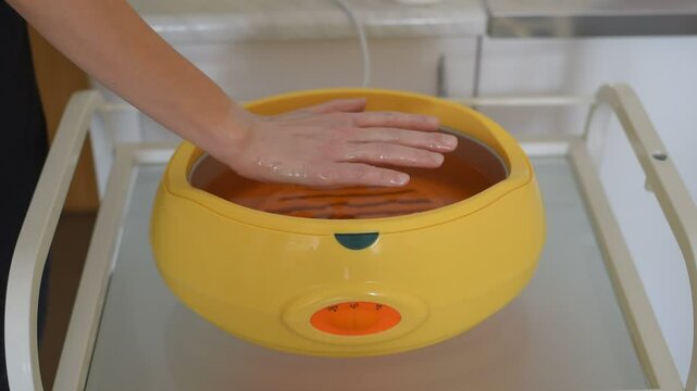 Paraffin therapy. Woman dipping her hand into a paraffin wax bath.