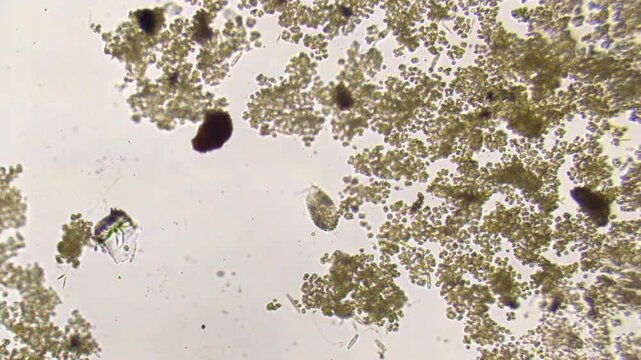 Freshwater infusoria - ciliates, protozoa, algae