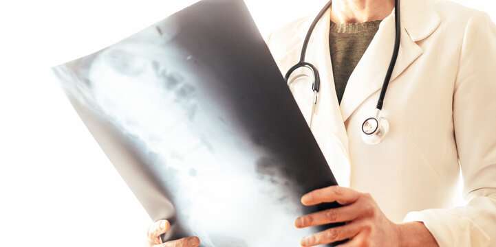 Doctor wearing a stethoscope and lab coat holding and examining an x-ray of bones, checking for potential diseases such as osteoporosis, cancer, or other bone-related conditions
