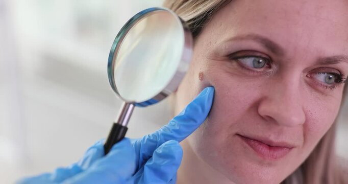Woman in latex gloves inspects facial birthmark with magnifying glass. Dermatologists analyses large mole on female patient cheek in clinic