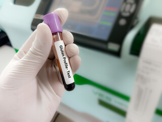 Doctor hold Blood sample for Gluten Profile test. Healthcare and medical test concept.