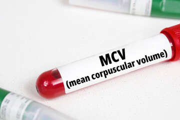 MCV (Mean Corpuscular Volume) title text of medical analysis