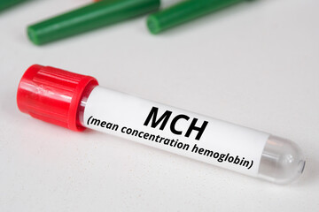MCH (Mean Concentration Hemoglobin) name of blood test