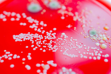 Bacterial and mold fungi colonies grown from indoor air on blood sheep agar