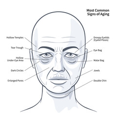 Most Common Signs of Aging. The woman faced age problems. Age skin. Healthcare vector illustration