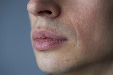 Close-up of a woman's lips and lower face with natural skin texture, blemishes, and soft lighting