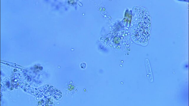 Amoeba crawling in lake water-400x