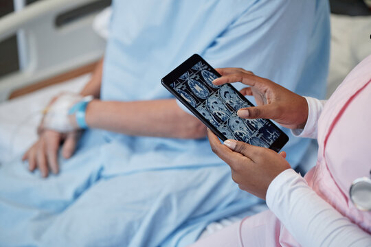Medical professional showcasing MRI scans on digital tablet while patient rests in hospital bed, emphasizing usage of modern technology and patient care