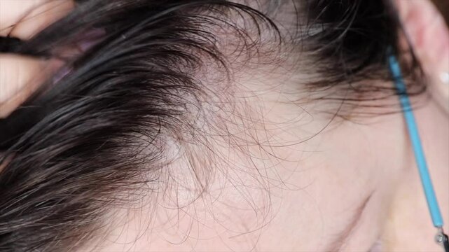 Woman touching her hair, revealing gray roots and scalp condition. Concept of alopecia, hair aging, and unwashed hair.