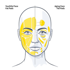 The Functional Anatomy of the Superficial Fat Pads Youthful and Aging Face vector illustration
