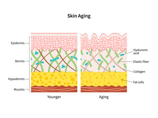 Skin aging process comparison of young and aged skin diagram vector illustration