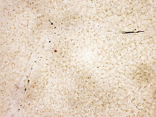 This is a single-celled frog egg photographed with a microscope, focusing on the embryo.Magnify 1000x
