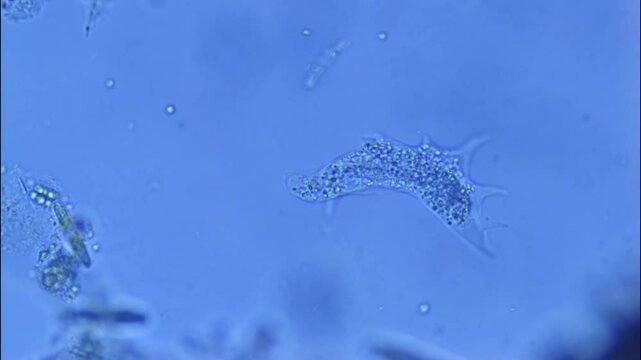 Amoeba extends pseudopods for motility and ingestion-400x