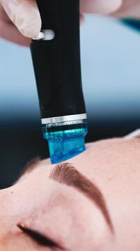 Modern cosmetology, premium skincare. Close-up of a modern hydrofacial device for vacuum cleansing, rejuvenation, moisturizing anti-age procedure. Macro shot, advertising. Vertical footage