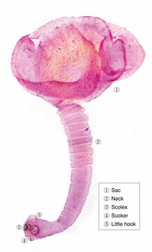 Porcine cysticercosis is the cysticercus of the tapeworm Taenia solium, which can parasitize the human brain, skin, and eyes, leading to the occurrence of diseases.Magnify 40x.
