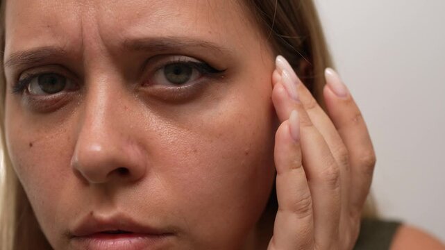 A young concerned woman gently touches the skin under her eyes, showing visible dark circles and puffiness. Her close-up expression reveals tiredness, under-eye swelling and a desire for care and rest
