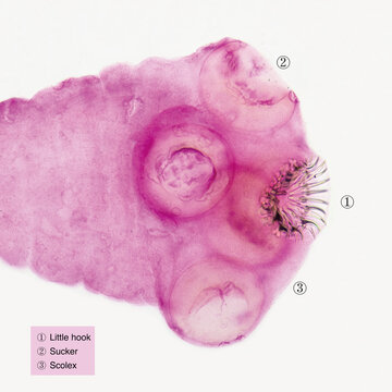 Cysticercus cellulosae is the cysticercus of Taenia solium, which can parasitize human brain, skin and eyes. This picture focuses on the scolex.Magnify 100x.
