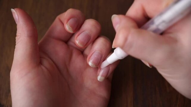 A woman applies a moisturizing cream-serum or cuticle oil to her nails. Nail care and manicure at home