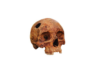 Genuine old human skull with a hole isolated on a transparent or white background