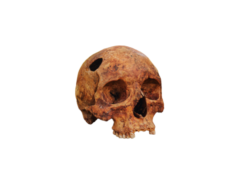 Genuine old human skull with a hole isolated on a transparent or white background