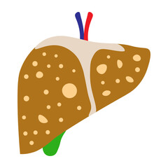 hemochromatosis