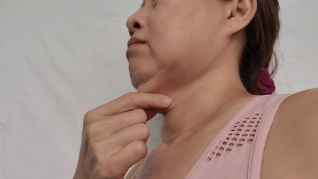 Portrait the wrinkle and Flabby skin, Flabbiness and loose, neck wattle and cellulite on the throat, double layer skin and creases on the body, health care and beauty concept.