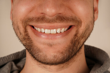 Perfect for themes of grooming and casual style. A detailed close-up of a man's chin with subtle stubble, showcasing masculine appeal. The unshaven look exudes effortless charm and simplicity.