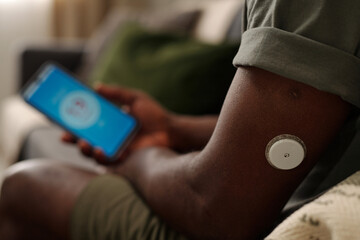 Close-up of person using smartphone for blood glucose monitoring showing patch on arm with focus on...