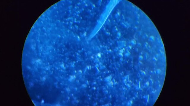 Decaying plant material with soil nematodes, protozoa, bacteria