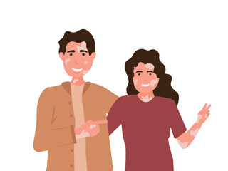 Young couple with vitiligo. Cartoon portraits of positive man and woman characters with vitiligo standing together over isolated background. Body positive, self love and depigmentation disease vector 