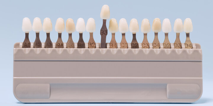 Dental tooth shade guide for color matching