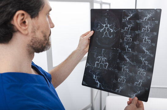 Neurologist examining cerebrovascular MRI image of brain during a medical consultation for patient with headaches and dizziness. Magnetic resonance angiography of head