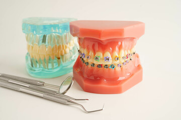 Teeth dental model with tool for dentist use to cleaning care treatment.