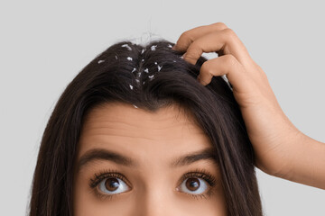 Young woman with dandruff problem on white background, closeup
